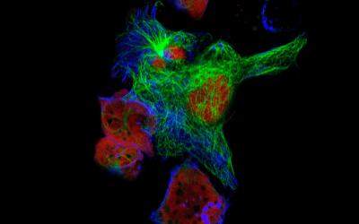 Newsletter: Overview of Advanced Fluorescence Microscopy Techniques