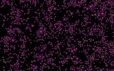 Newsletter: Tyramide Signal Amplification in Microscopy and Spatial Proteomics