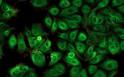 Newsletter: Fluorescent proteins: advantages and disadvantages