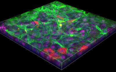 Confocal vs Super-Resolution Microscopy