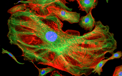 Picture Perfect: Capturing a High-Quality Fluorescent Microscopy Image
