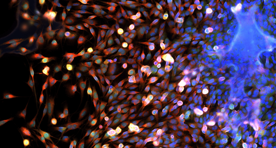 Multiplexing with Spectral Confocal Fluorescence Microscopy