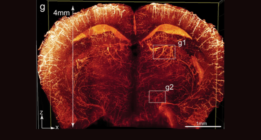 COVER Imaging of the whole-brain vasculatures at sub-cellular resolution.