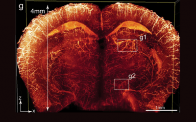 Clearing Tissue for Microscopy: Part 1 – Dehydration Protocols