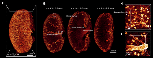 Figure 4. 3D visualization of the vasculature in the kidney after FDISCO clearing.