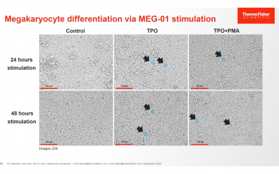 Optimizing Large Particle Sorting: Characterizing and Evaluating Differentiated Megakaryoblasts Using a Combined Workflow