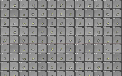 Imaging Flow Cytometry