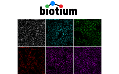 Biotium Launches GlycoLiner™ Cell Surface Glycoprotein Labeling Kits for Rapid and Selective Cell Surface Imaging