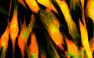 Live-Cell Migration, Invasion, and Adhesion Assays: Methods and Imaging Approaches