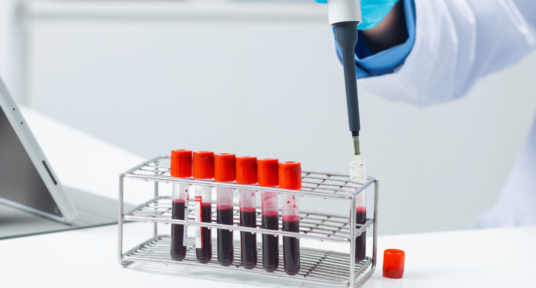 Researcher pipetting samples into tubes during flow cytometry sample preparation