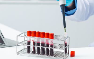 Flow Cytometry Sample Preparation: Tips, Protocol Steps, and Best Practices