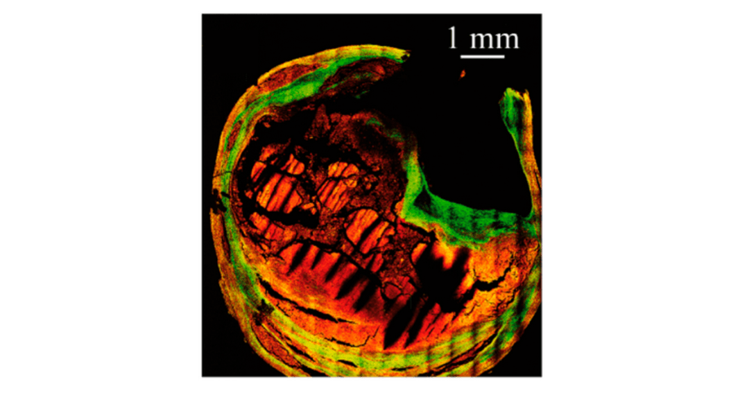 Multiphoton (red) and Second Harmonic Generation (green) image of a human carotid cross-section.