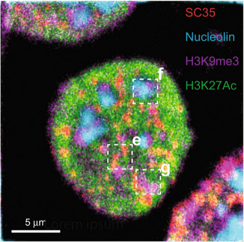 Figure 3. Composite HD-MIBI image of nucleolin (cyan), H3K9me3 (magenta), H3K27Ac (green), and SC35 (red) in a HeLa cell.