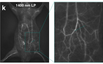 Increasing signal to noise ratio in fluorescence microscopy and blocking methods