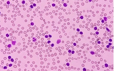 IHC vs. ICC vs. IF: What’s the Difference?