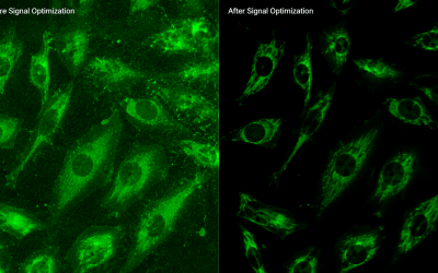 Increasing signal to noise ratio in fluorescence microscopy and blocking methods