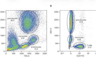 Clinical Flow Cytometry: Where Measurement Meets Medicine